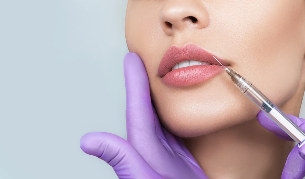 Lip Filler Treatments in Beverly Hills, CA